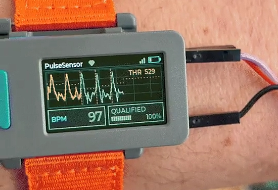 PulseLink Remote Display